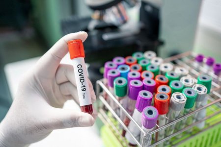 Azərbaycanda ümumilikdə 779 508 koronavirus testi aparılıb