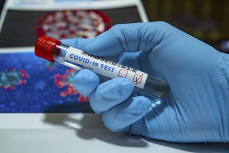 Azərbaycanda 849 min 628 nəfər koronavirus testindən keçib  