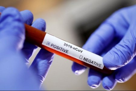 Azərbaycanda indiyədək 898 492 koronavirus testi aparılıb