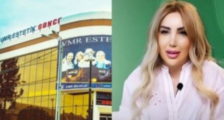 Gülsüm Əliyeva həkim deyilmiş: 