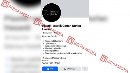 Plastik cərrah kimi fəliyyətinə rəsmən icazə verilməyən Nurlan Həsənli yenidən İŞ BAŞINDA –  