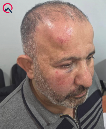 Ata və oğul "Azəriqaz"ın evə çağırdıqları əməkdaşını döyüblər? - 