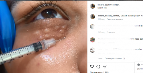 Baş həkim Elnarə Canlının ali tibbi təhsili varmı?