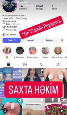Davinçi Estetik Klinikasında qanunsuz estetik əməliyyat icra edən kimlərdir?