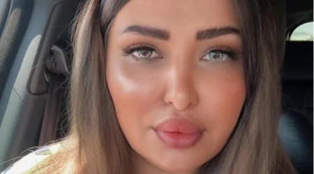 “İnex” şirkəti ilə lazeroloqlar arasında qalmaqal – 