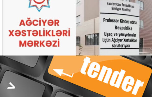 “AXS” yoxsa, “YUNEST” MMC – Satınalmalarda belə gizli işlərə şəraiti kimlər yaradır –